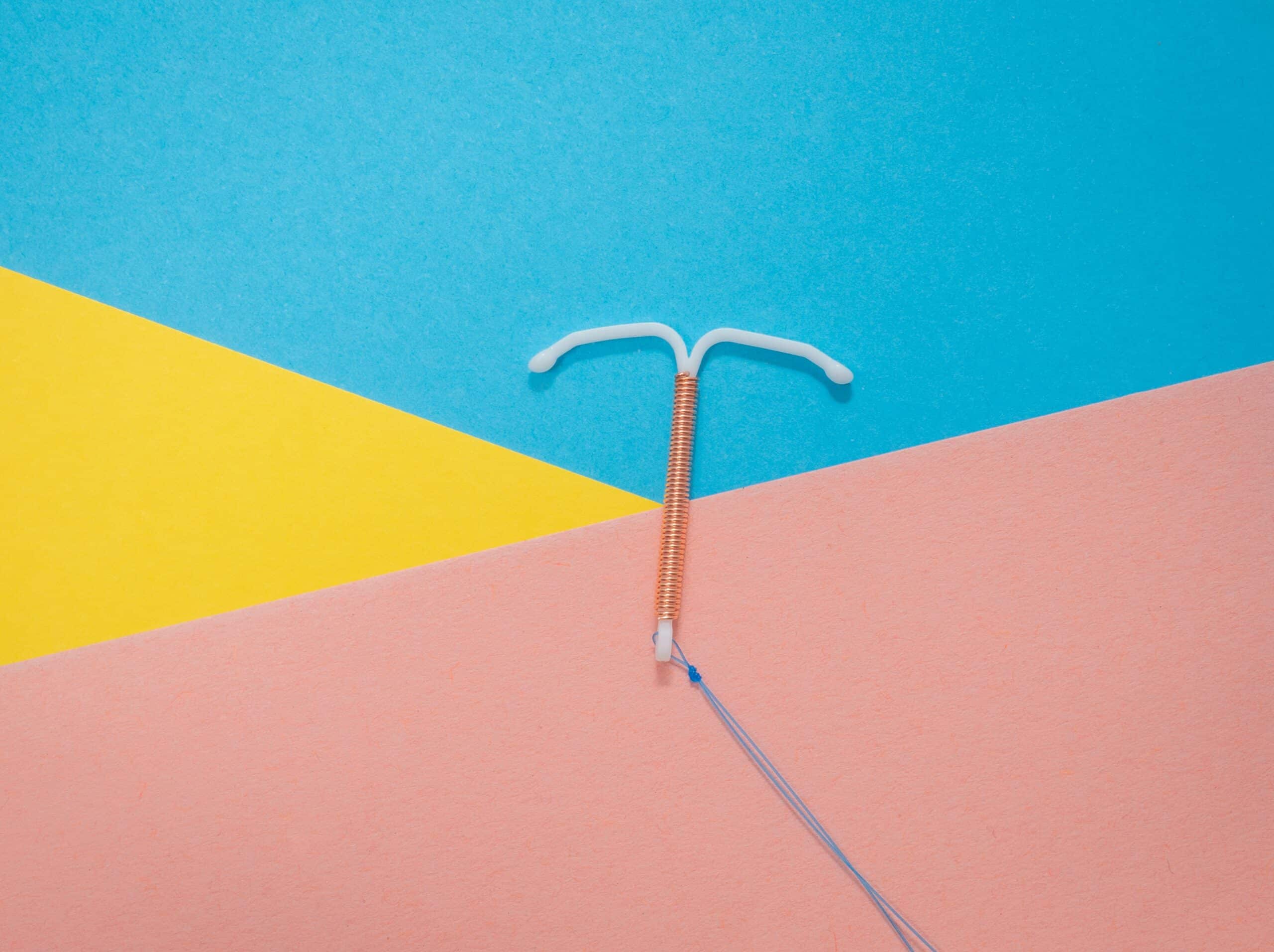 IUD birth control method